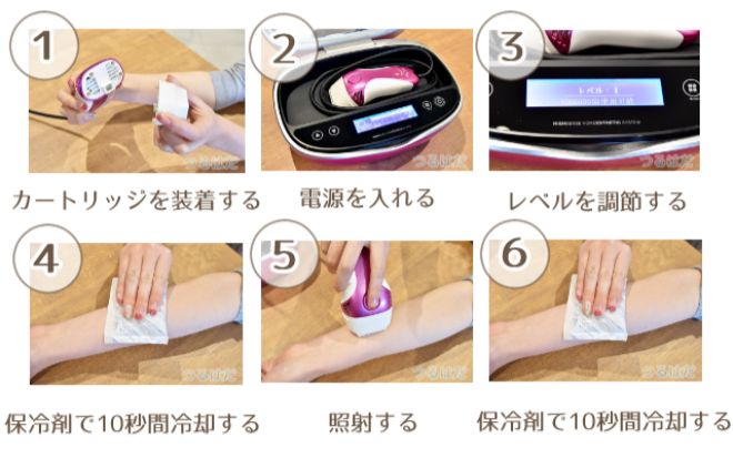 男性必見 脱毛器ケノンで青ヒゲと決別しよう - 脱毛つるはだ