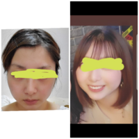 小顔になる方法セルフケアから美容施術まで幅広く紹介！│SELECT CLINIC TIPS