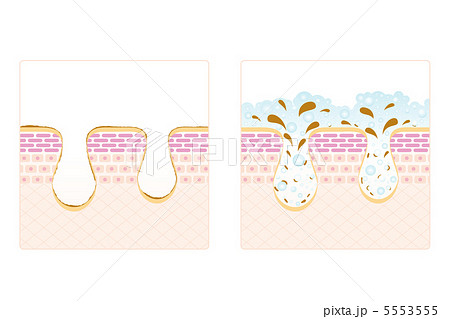 皮膚説明図の断面図 - 断面のベクターアート素材や画像を多数ご用意 - 断面, 皮膚, 毛穴 - iStock