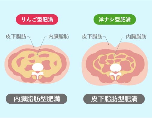 太りすぎの人。ビール腹、失敗したダイエットと貧しい食生活の象徴的な写真。の写真素材・画像素材 Image 30894730
