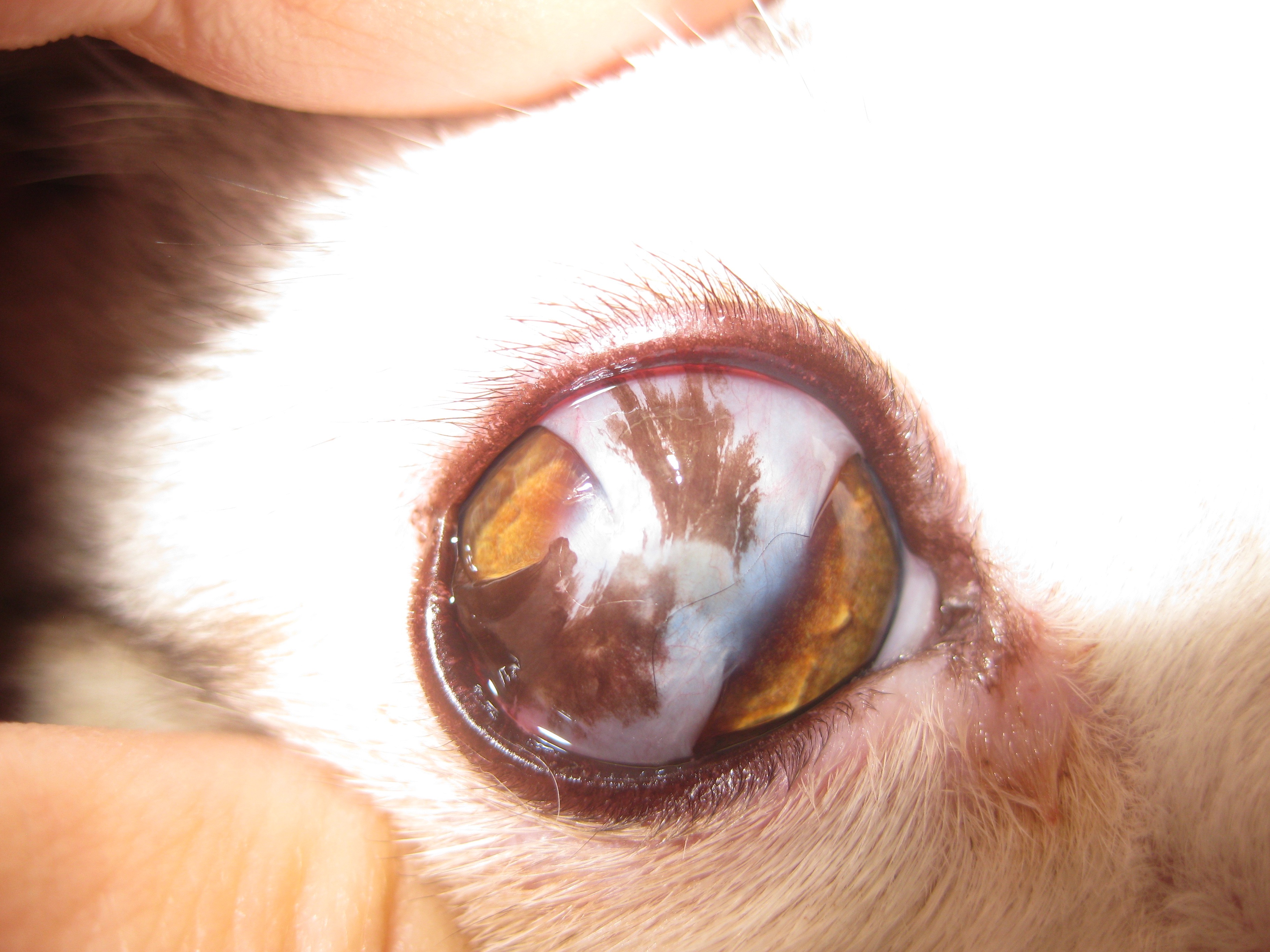 白内障手術症例② 成熟白内障- 新江古田いわた眼科