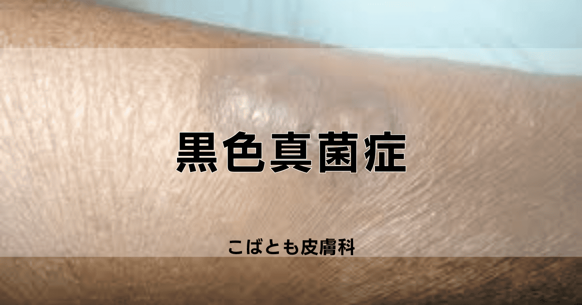 子猫の脱毛・皮膚糸状菌症 カビ・真菌症- 症例集 - 練馬で犬猫の歯科なら ポラン動物病院