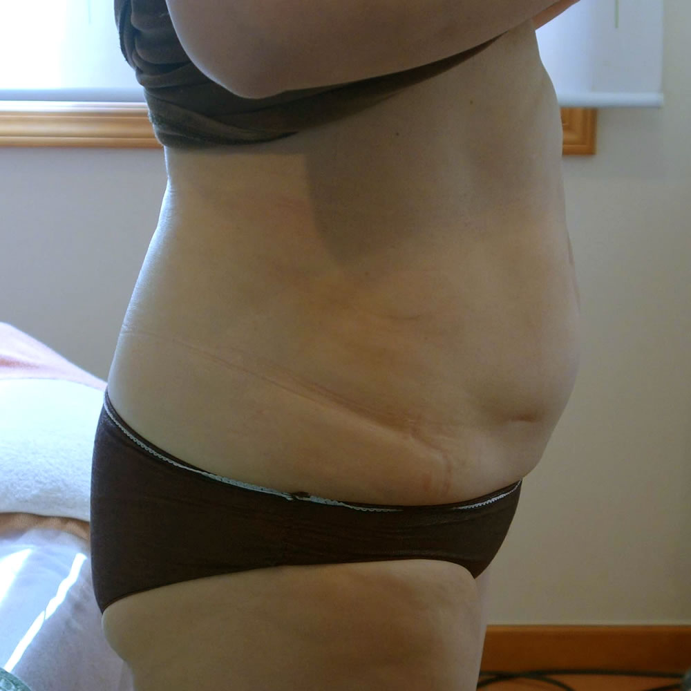 八尾久宝寺 駅近！部分痩せダイエット・キャビテーション・ラジオ波痩身・酵素ファスティングダイエット・部分痩せ・セルライト・むくみ解消♪キャビテーション・ラジオ波・リンパマッサージ・ＥＭＳ・遠赤外線で結果を出す！近鉄八尾・志紀・加美・東大阪市・平野・柏原