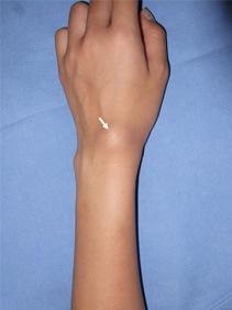 取り扱い疾患 手の外科 TMGあさか医療センター 整形外科