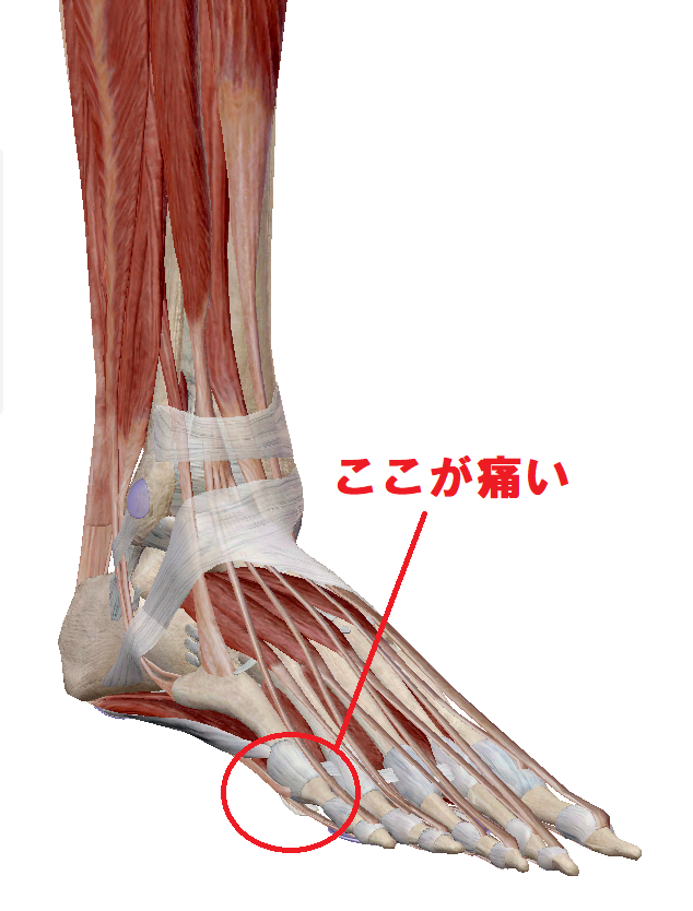 小指の骨が痛い原因と対処法考えられる病気と受診の目安「さかぐち整骨院 -枚方市-」枚方市で口コミ評価NO.1