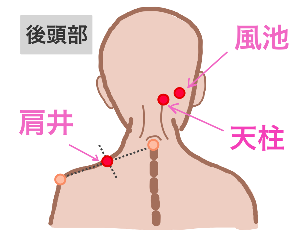 緊張性頭痛によく効くツボ天柱・完骨錦糸町：肩こり首こり肩甲骨の痛みがスッキリ解消