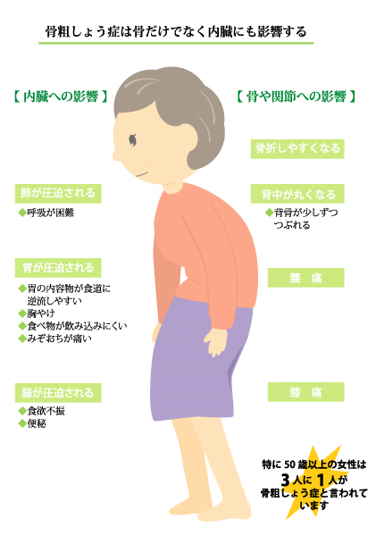 お知らせ・ブログ歳を取るとになると背が縮む！？ちくさ病院の在宅医療