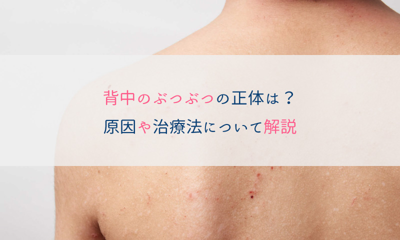 名古屋市の美容外科・皮膚科・形成外科ならさかえクリニック» Blog Archive ワキガ治療 マイクロニードル治療の瘢痕 -名古屋市の美容外科・皮膚科・形成外科ならさかえクリニック