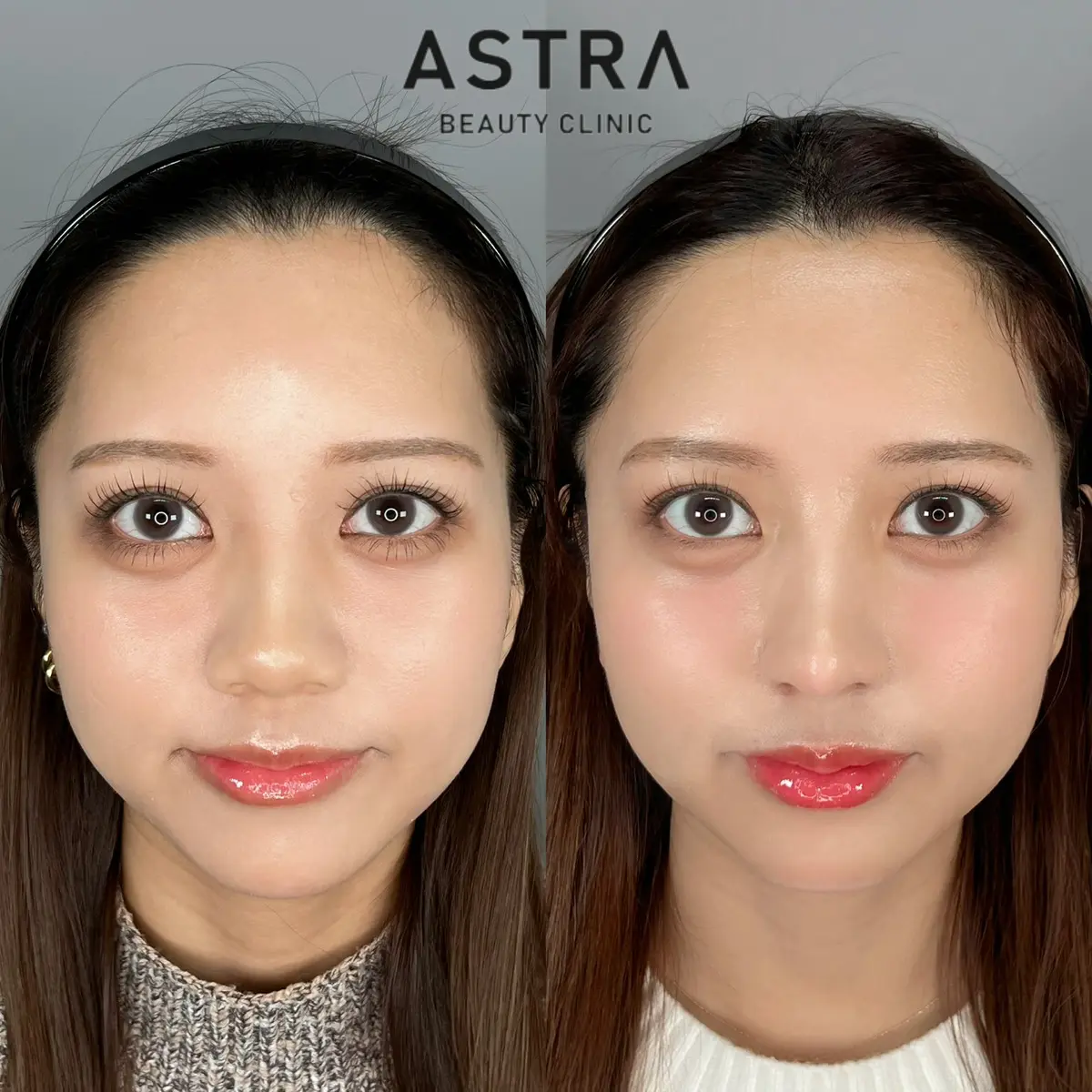 岡山県版 鼻整形ドクター名鑑