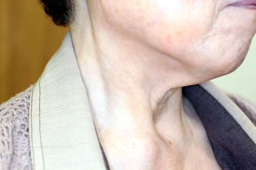 シミ取り治療・レーザーならコアラ皮膚科・美容皮膚科クリニック三軒茶屋三軒茶屋・池尻大橋・駒沢大学・若林・世田谷