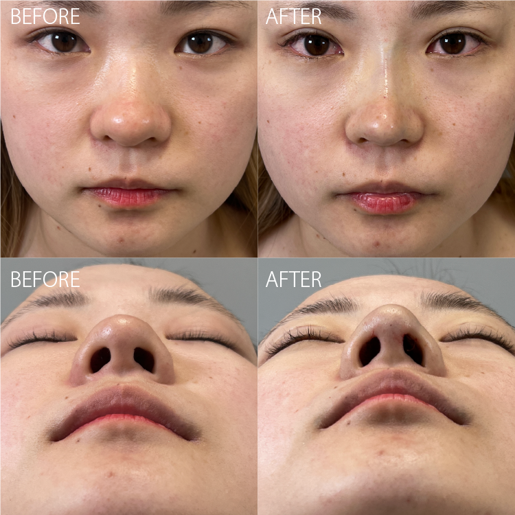 岡山院の鼻整形eクリニック岡山院 公式 美容整形・美容外科