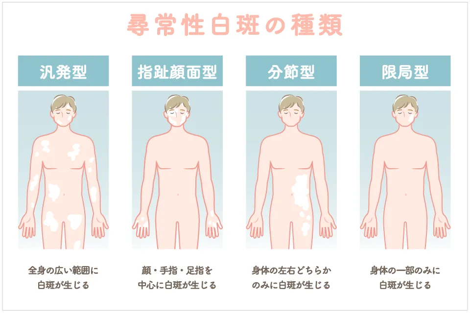 腕のシミと白い斑点それらは茶色灰色または黒い斑点であり肝斑老人性レンチゴ太陽レンチジンまたは太陽黒点とも呼ばれます -メラニンのストックフォトや画像を多数ご用意 - iStock