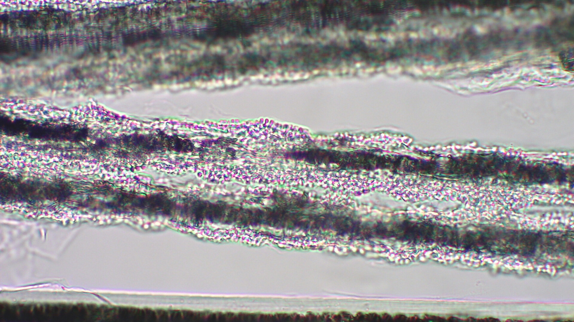 私の皮膚の問題は真菌性ですか?抗真菌クリームを塗ったほうがいいでしょうか？ – AMPERNA®