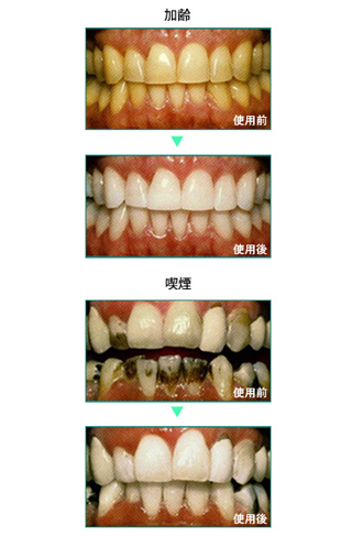 ホワイトニング島歯科・矯正歯科