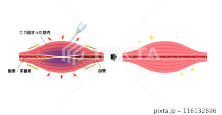 緩和ケア のイラスト素材・ベクター - 123RF