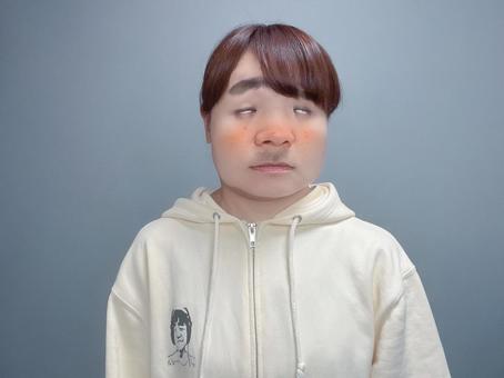 正常な白目の断面と瞼裂斑の白目の断面のイラスト - 医療のイラスト・写真・動画、素材販売サイトのメディック medick