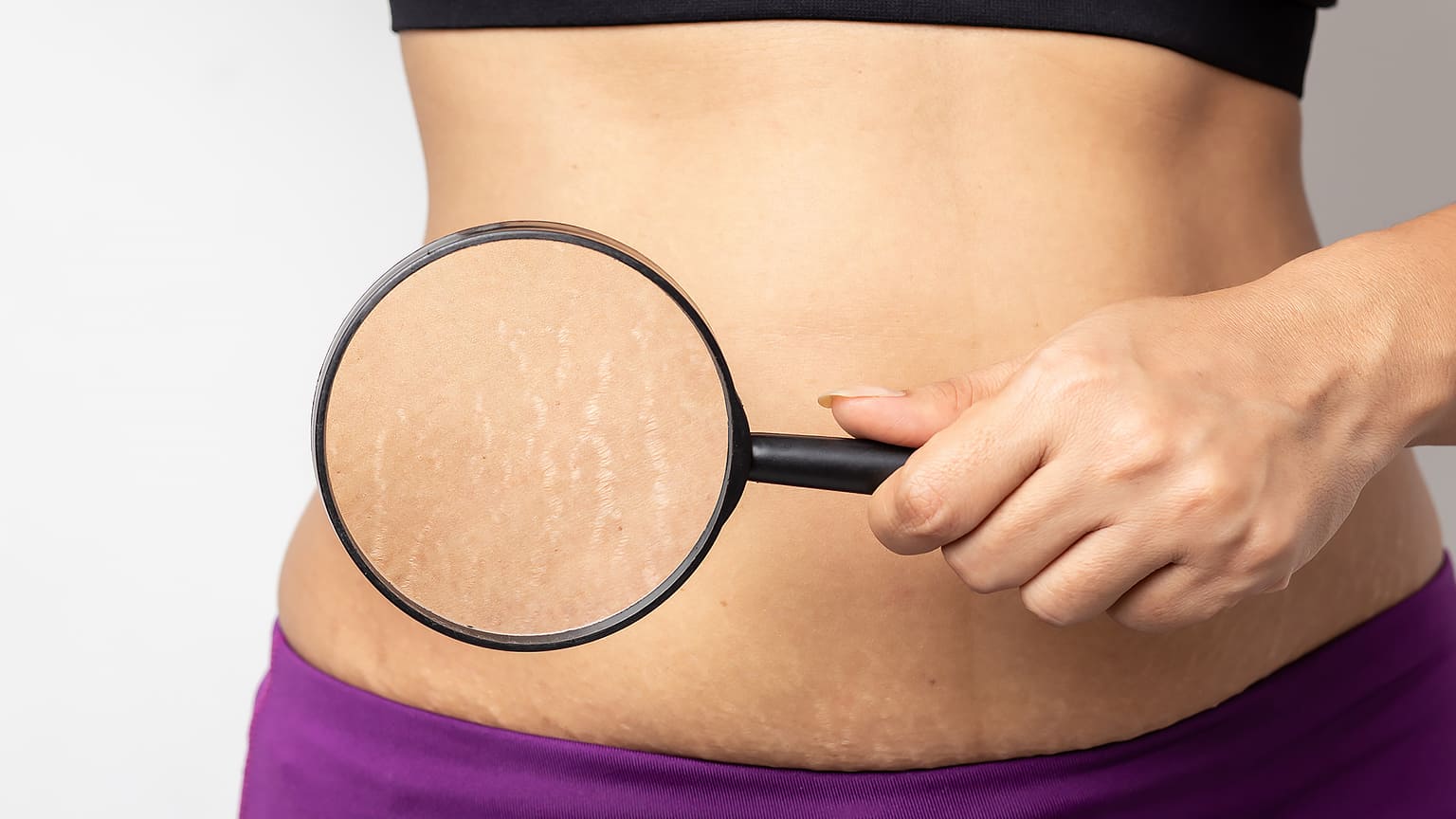腰回りが急に太る5つの病気。お腹の張り・急激な体重増加に注意！Medicalook メディカルック