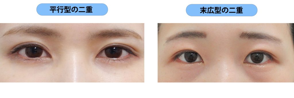 なぜ女性の眠そうな目や顔を見て男性はかわいいと思うのか？理由と心理や特徴とは - ブレラブ