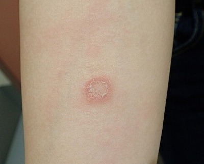 皮膚真菌症松原動物病院 公式 愛知県半田市の動物病院