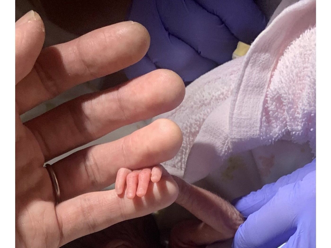 ANA、赤ちゃんが泣かない機内づくり挑戦 心拍数で赤ちゃんの大泣き予知