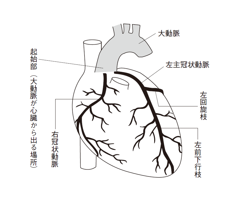 動脈管開存症の経皮的閉鎖循環器内科仙台厚生病院