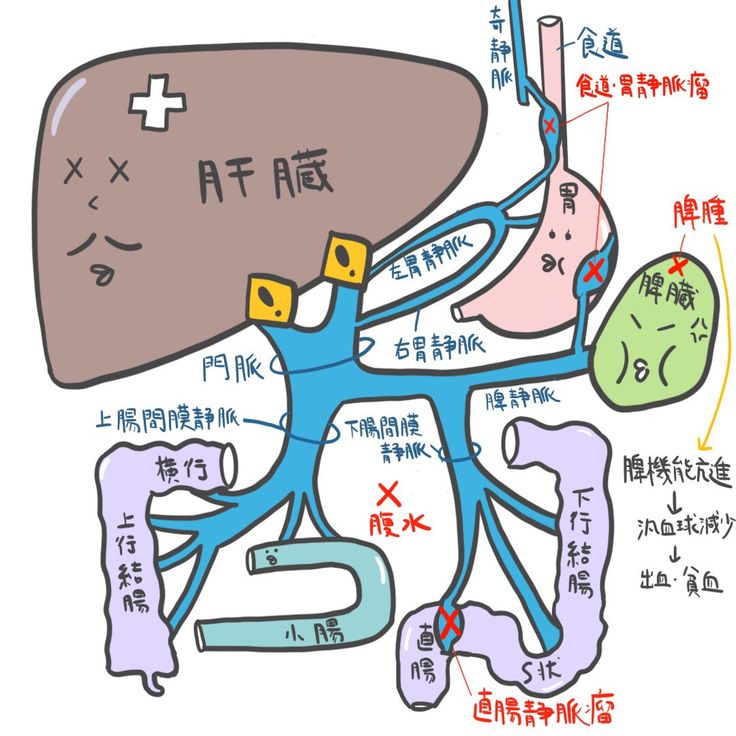 生理痛イラスト無料イラスト・フリー素材なら「イラストAC」