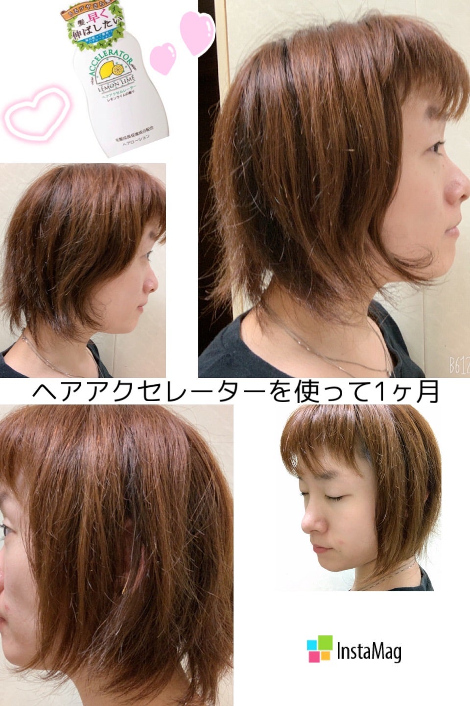 ヘアアクセルレーターEX ＜シトラススカッシュの香り＞ – 加美乃素 育毛剤、養毛剤、白髪染め