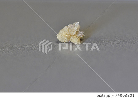 尿路結石症東京慈恵会医科大学附属 柏病院 泌尿器科