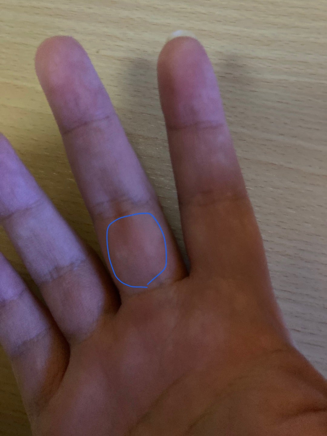 手・指のほくろの意味を位置ごとに解説！ ほくろ占いplush