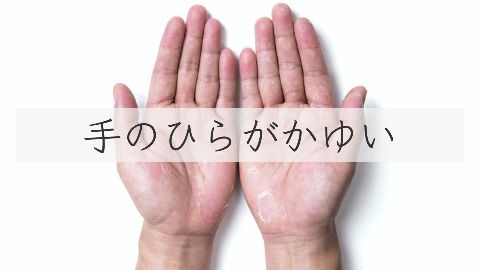 手のかゆみ原因・対処法大正健康ナビ大正製薬