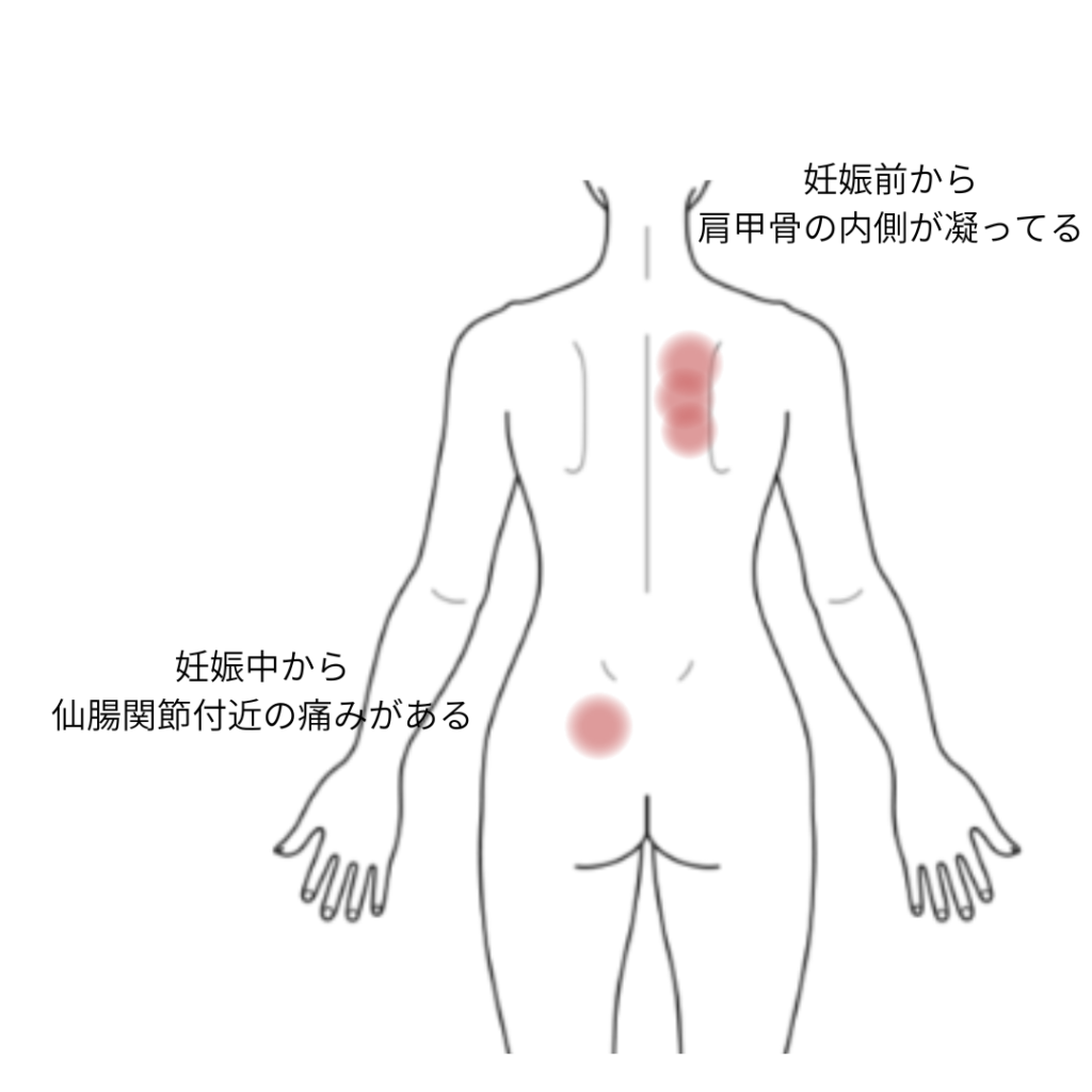 激しい下痢の後、食欲不振と胃痛と背中の痛み背部痛、胃痛のツボツボネット 鍼灸の症例が検索できるツボ辞典