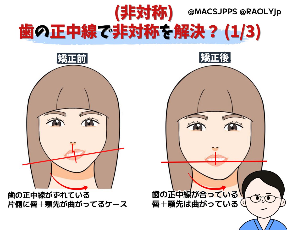人相学で、教えてくだされ。 - 右側の口の端が上がるようにゆがん- Yahoo!知恵袋