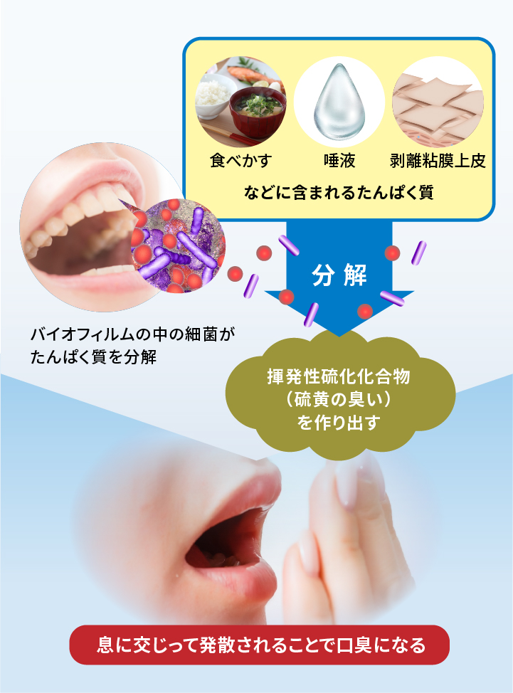 被せ物の横をフロスしたら臭いのはなぜ？なんばクローバー歯科 よくあるご質問