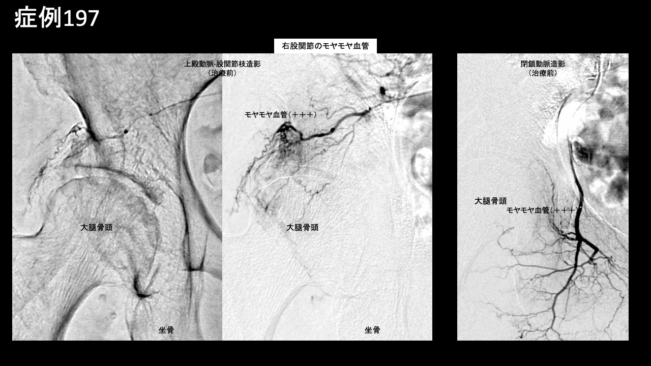 Terminologia Anatomica TA に基づく解剖学
