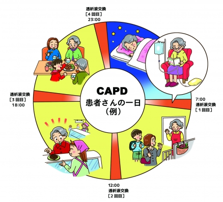 腹膜透析イラスト無料イラスト・フリー素材なら「イラストAC」