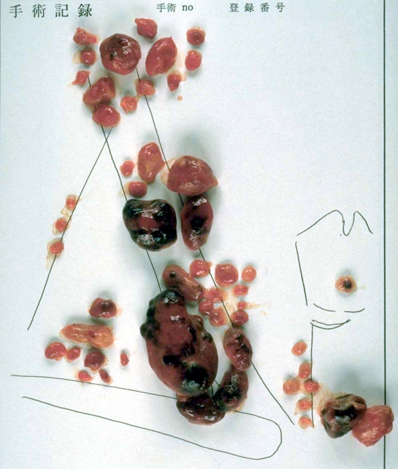 頭頸部の症状はま耳鼻咽喉科クリニック