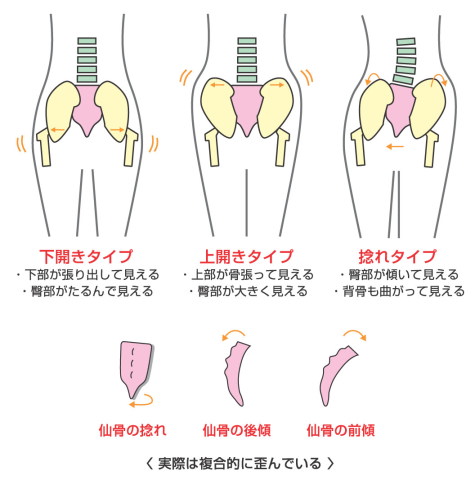 骨盤の動きとは？固い原因・整え方・セルフケアをやさしく解説「さかぐち整骨院 -枚方市-」枚方市で口コミ評価NO.1