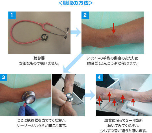 実習お役立ち特集4. 聴診器の使い方？ - がんばれ看護学生! メディックメディア