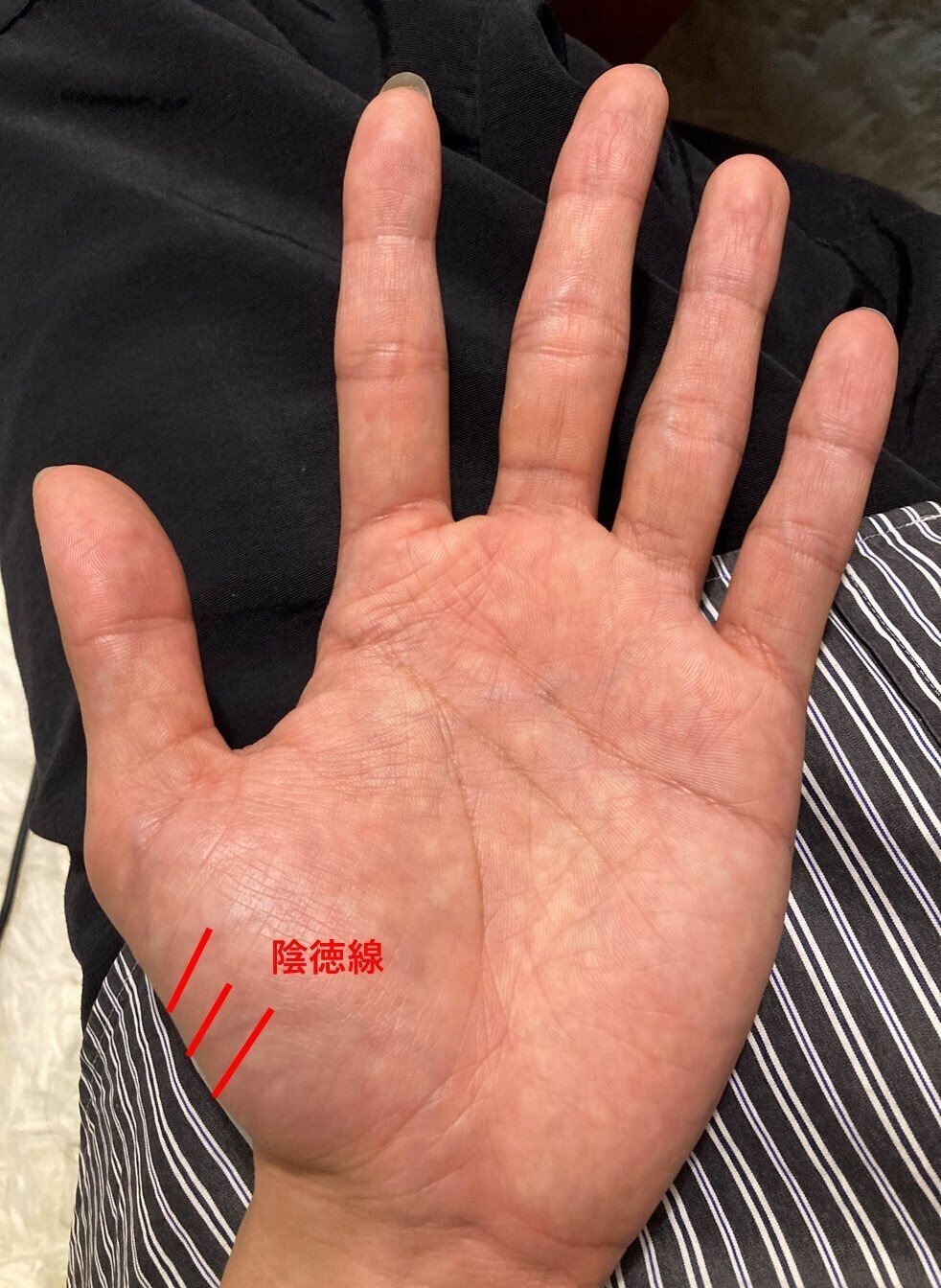 画像で手相鑑定！辛かった経験を活かしてお仕事に！ - 寄り添う手相 aki