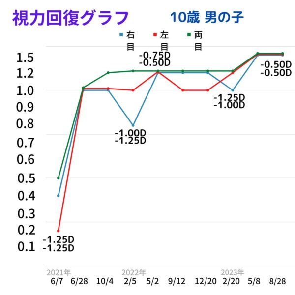 視力を上げる方法基本5選-視力回復 アイメディカル西宮