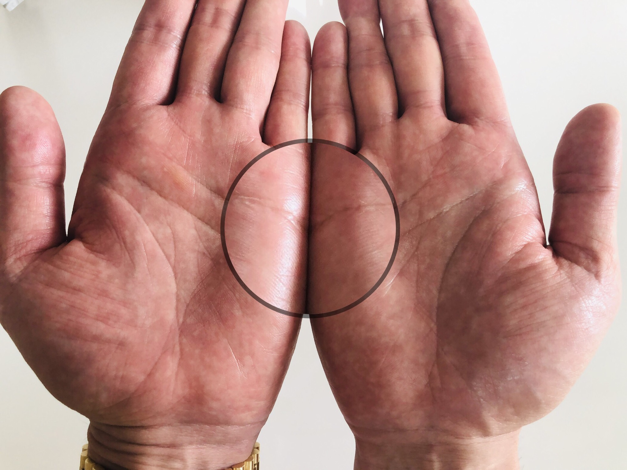 頭脳線とは？意味や見方を種類別に解説！大串ノリコの手相占い - 大串ノリコの紫微斗数と姓名判断