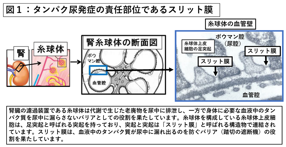 タンパク尿 – フリーイラスト素材集 KuKuKeKe