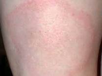 たかがノミと言うなかれ。イデア動物病院大阪府枚方市津田南町の動物病院