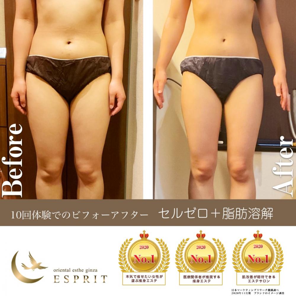 メンズ痩身エステ 都度払い メンズフェイシャル・男性痩身エステならフィーゴビューティ