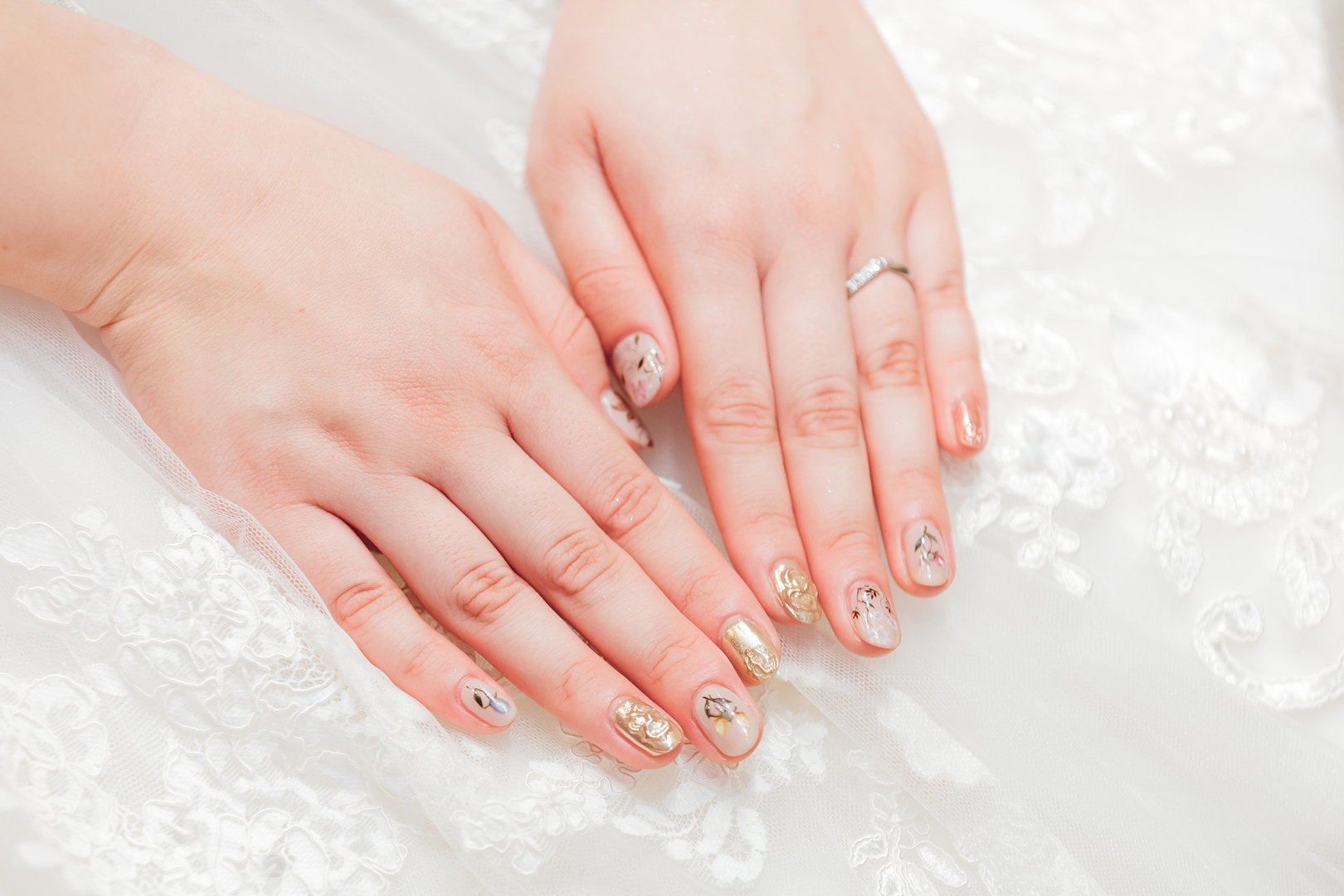 手背・指の悩み名古屋タワーサイドクリニック