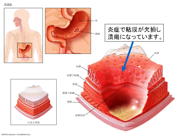 超音波検査 十二指腸- たなべ内科クリニック 呉市広本町の内科・内視鏡クリニック
