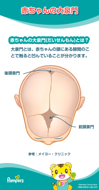 東京 文京区 で単純性血管腫 ポートワイン母斑 の治療を検討している方へ皮ふと子どものあざクリニック茗荷谷