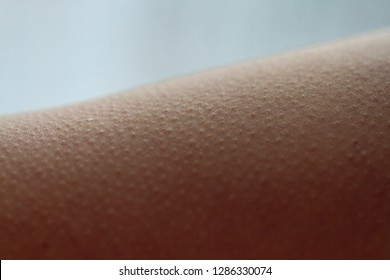 寒くも怖くもないのに収まらない鳥肌 毛孔性角化症かも？チャン皮膚科