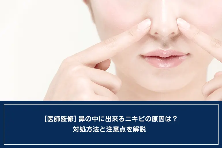 鼻の下にニキビがよくできるのはなぜ？原因や早く治す方法を解説ANS. magazine