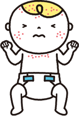 新生児トラブル 蕁麻疹 じんましん- 東京の産後ケアサービス「産後ママたすけ隊」